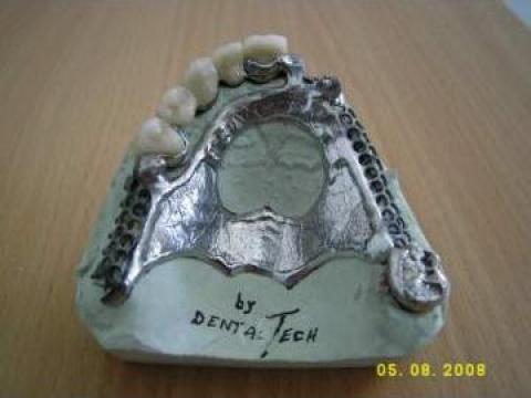 Proteza scheltata de la Dentaltech