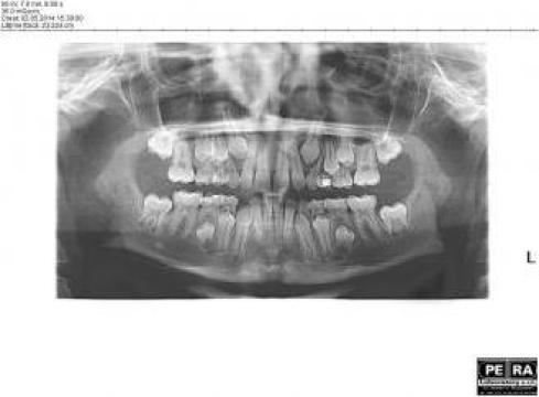 Ortopantomograma copil (OPG Digital Pediatric) de la Petra Laboratory - Centrul De Radiologie Digitala Stomatolog