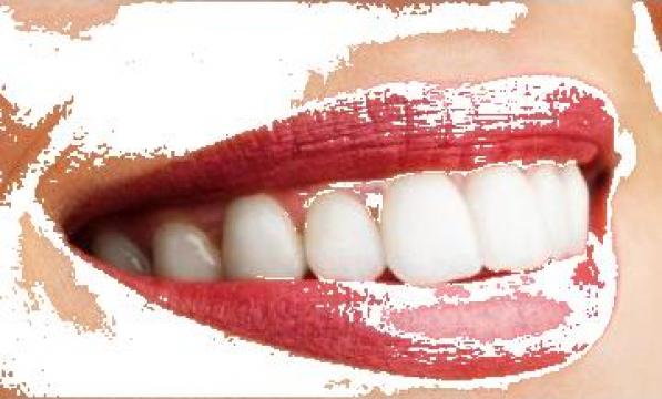 Servicii stomatologice de la Ony Dental