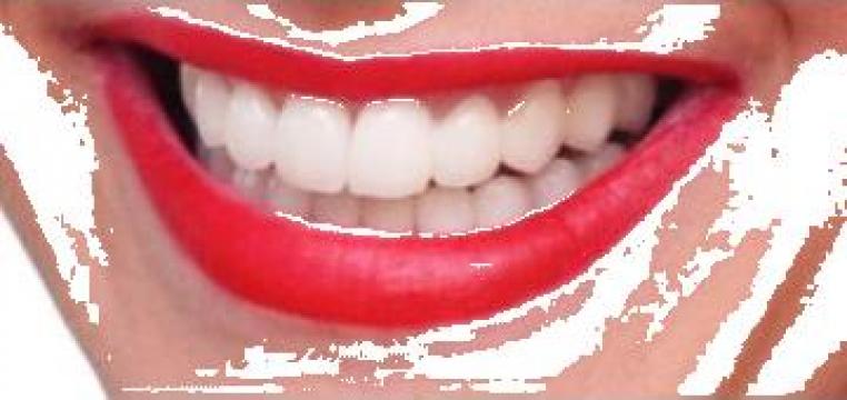 Albire dentara de la Ony Dental